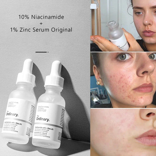 The Ordinary Niacinamide 10% + Zinc 1% - 30ml
